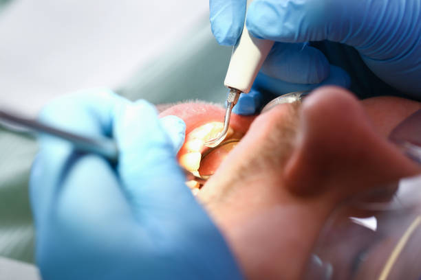 Best Cosmetic Emergency Dentistry in Jackson, TN