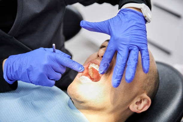 Best Emergency Wisdom Teeth Removal in Jackson, TN